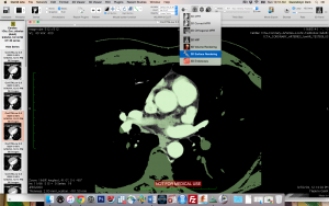 image 12 surface rendering