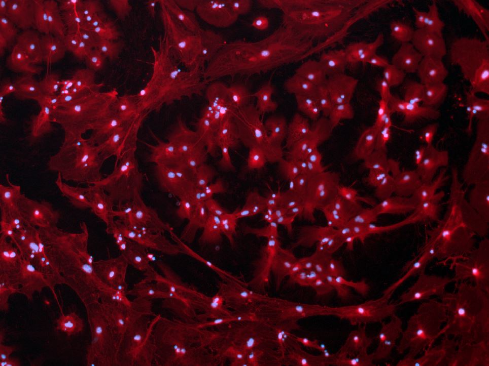 IL1beta-Astrocytes