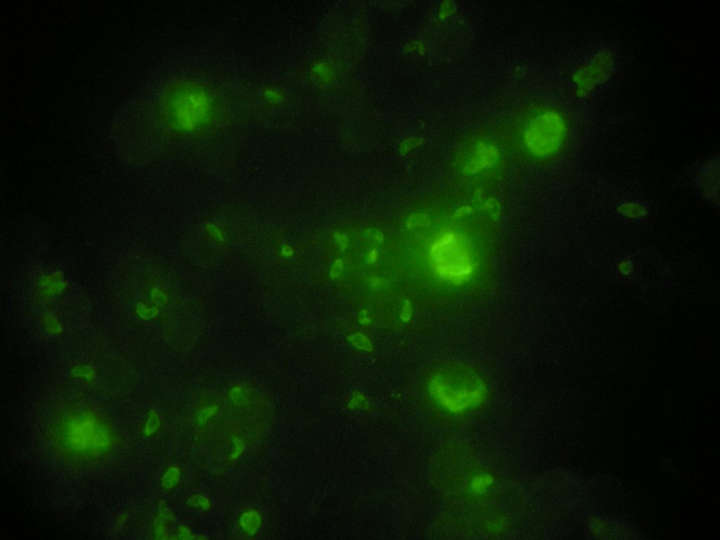 Toxoplasma gondii - Immunofluorescence