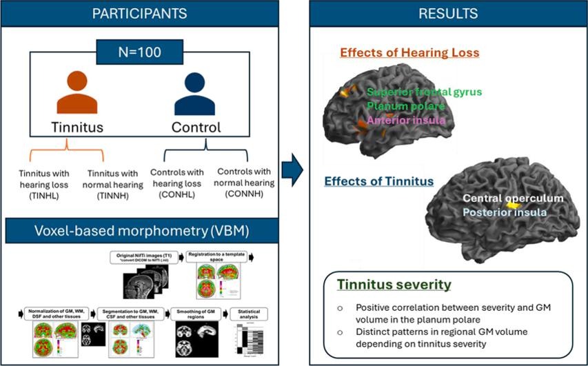 A graphical abstract mapping a brain imaging study of tinnitus and hearing loss using voxel-based morphometry (VBM). Under the participants section, a flowchart indicates a cohort of N=100 broken down into tinnitus and control groups, further subdivided by normal hearing or hearing loss. Under the results section, two brain diagrams display localized structural effects: the top brain highlights gray matter volume changes associated with the effects of hearing loss in the superior temporal gyrus, planum polare, and inferior insula, and the bottom brain highlights changes associated with the effects of tinnitus in the central operculum and posterior insula. A separate box outlines conclusions regarding tinnitus severity, noting a positive correlation between severity and gray matter volume in the planum polare.