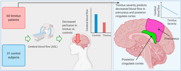 A graphical abstract mapping a brain imaging study of tinnitus severity using arterial spin labeling (ASL) cerebral blood flow (CBF). Under the participants section on the left, a flowchart breaks down a cohort into 60 tinnitus patients and 31 control subjects. Arrows point toward a central diagram showing a sagittal brain view with blue and red arrows representing cerebral blood flow. To the right, a bar graph compares cerebral blood flow between controls and tinnitus patients, showing decreased perfusion in the tinnitus group. An adjacent sagittal brain diagram highlights the locations of the precuneus and posterior cingulate cortex, with an arrow pointing to a separate line graph that demonstrates a negative correlation between regional blood flow and tinnitus severity.