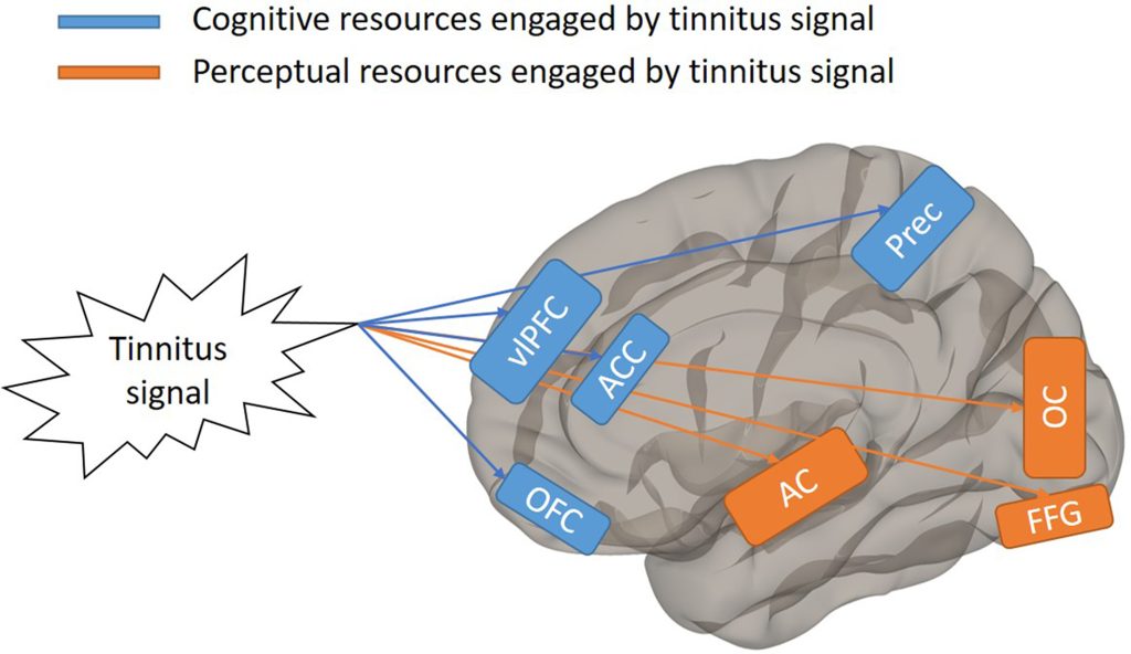 A graphical abstract illustrating a conceptual model of cognitive and perceptual resource engagement by a tinnitus signal. On the left, an icon labeled tinnitus signal sends divergent pathways to a diagram of a human brain on the right. Blue lines represent cognitive resources engaged by the tinnitus signal, which map to the ventrolateral prefrontal cortex (vlPFC), anterior cingulate cortex (ACC), orbitofrontal cortex (OFC), and precuneus (Prec). Orange lines represent perceptual resources engaged by the tinnitus signal, mapping to the auditory cortex (AC), occipital cortex (OC), and fusiform gyrus (FFG). A legend in the upper left defines the color-coded blue pathway as cognitive resources engaged by tinnitus signal, and the orange pathway as perceptual resources engaged by tinnitus signal. 