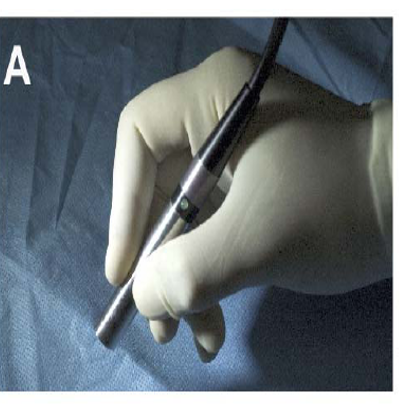 Image-Guided Cancer Surgery – Nie Lab